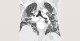 3-p1-3-radiology-chest