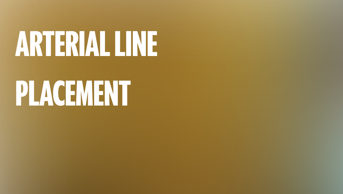 Arterial Line Placement