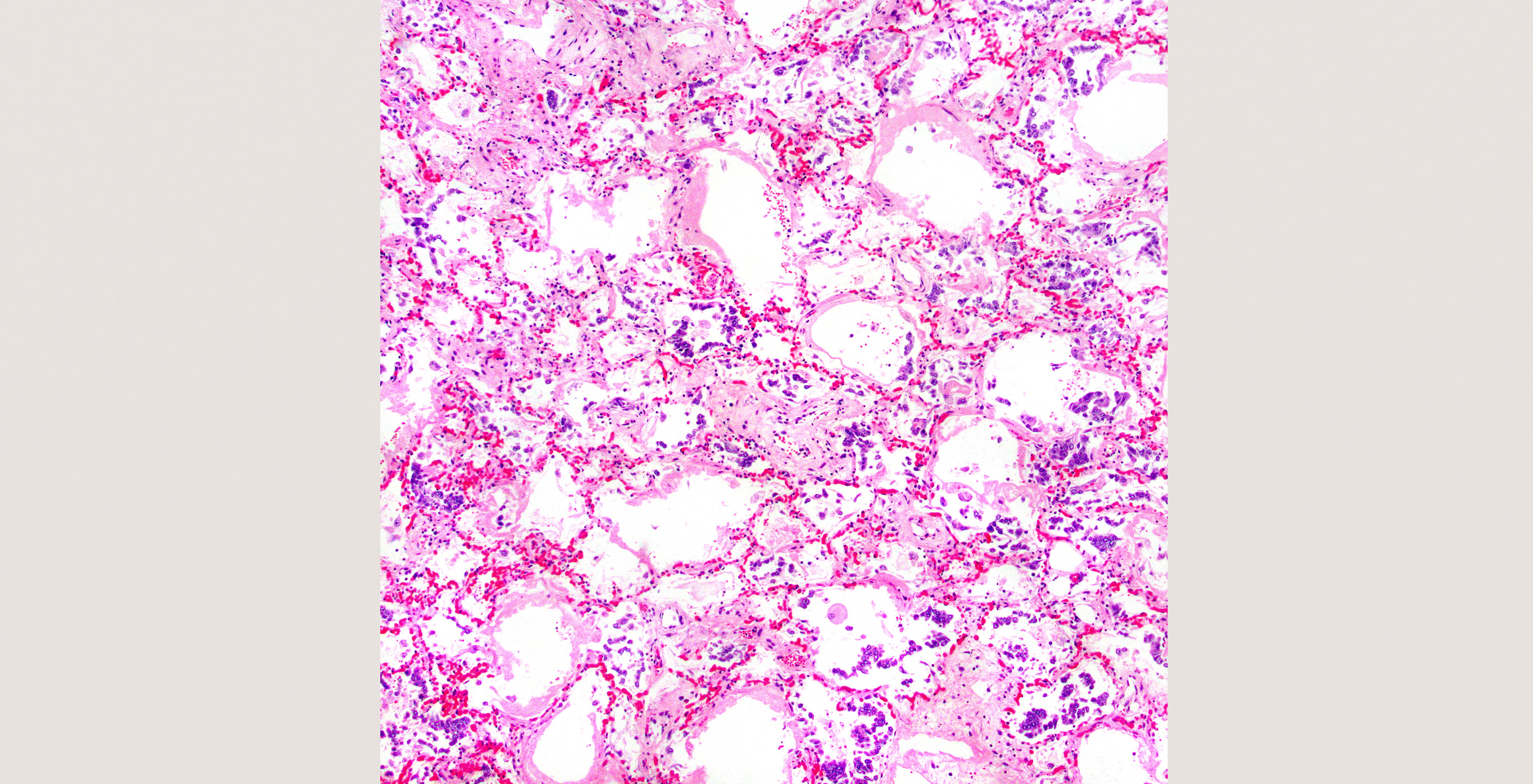 4-p1-4-pathology-id