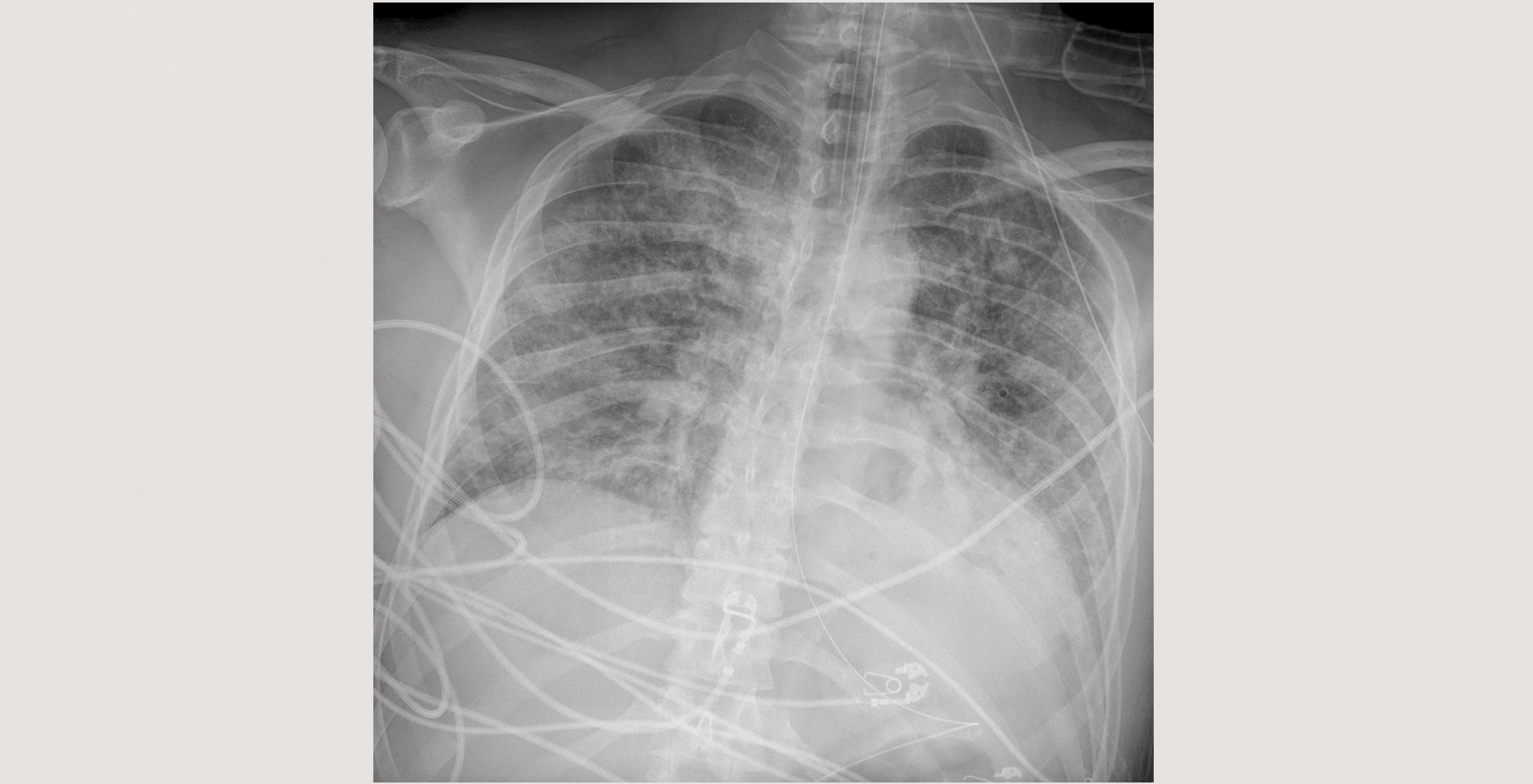 4-p1-4-radiology-chest