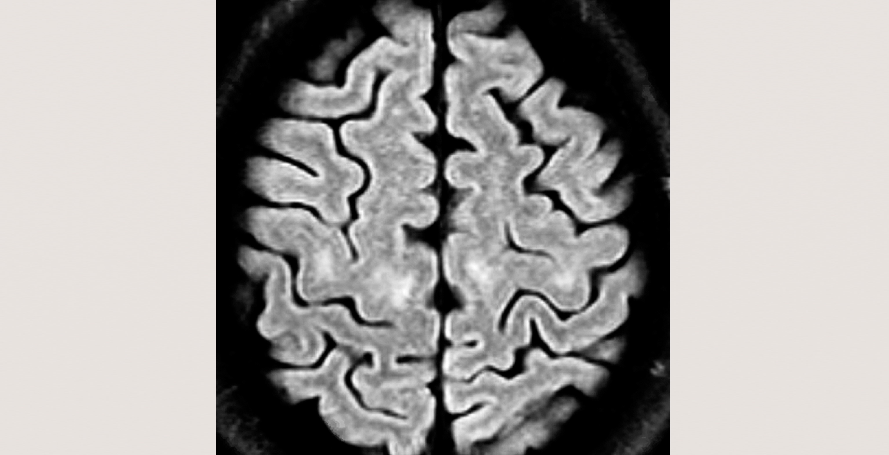 d1-radiology-brain