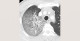 d3-radiology-viral-pneumonia