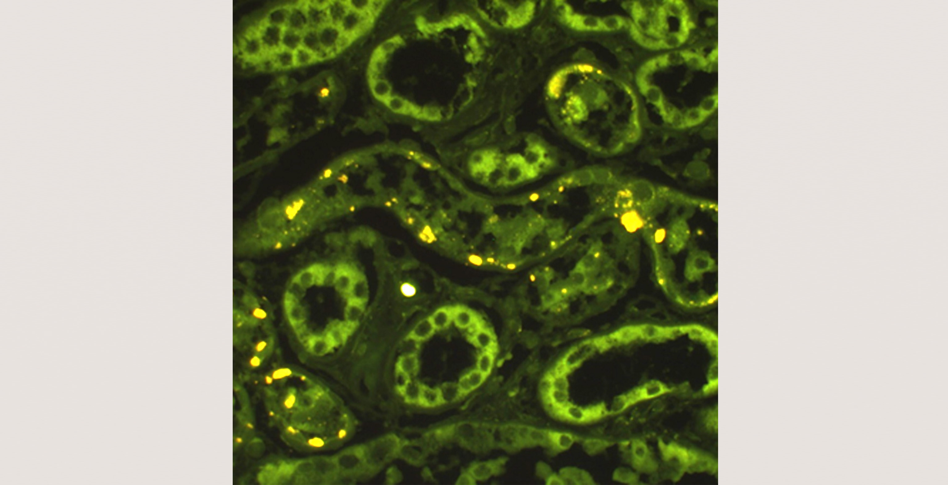 pathology-nephrology-9-p4-5