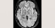 7-p4-3-radiology-brain