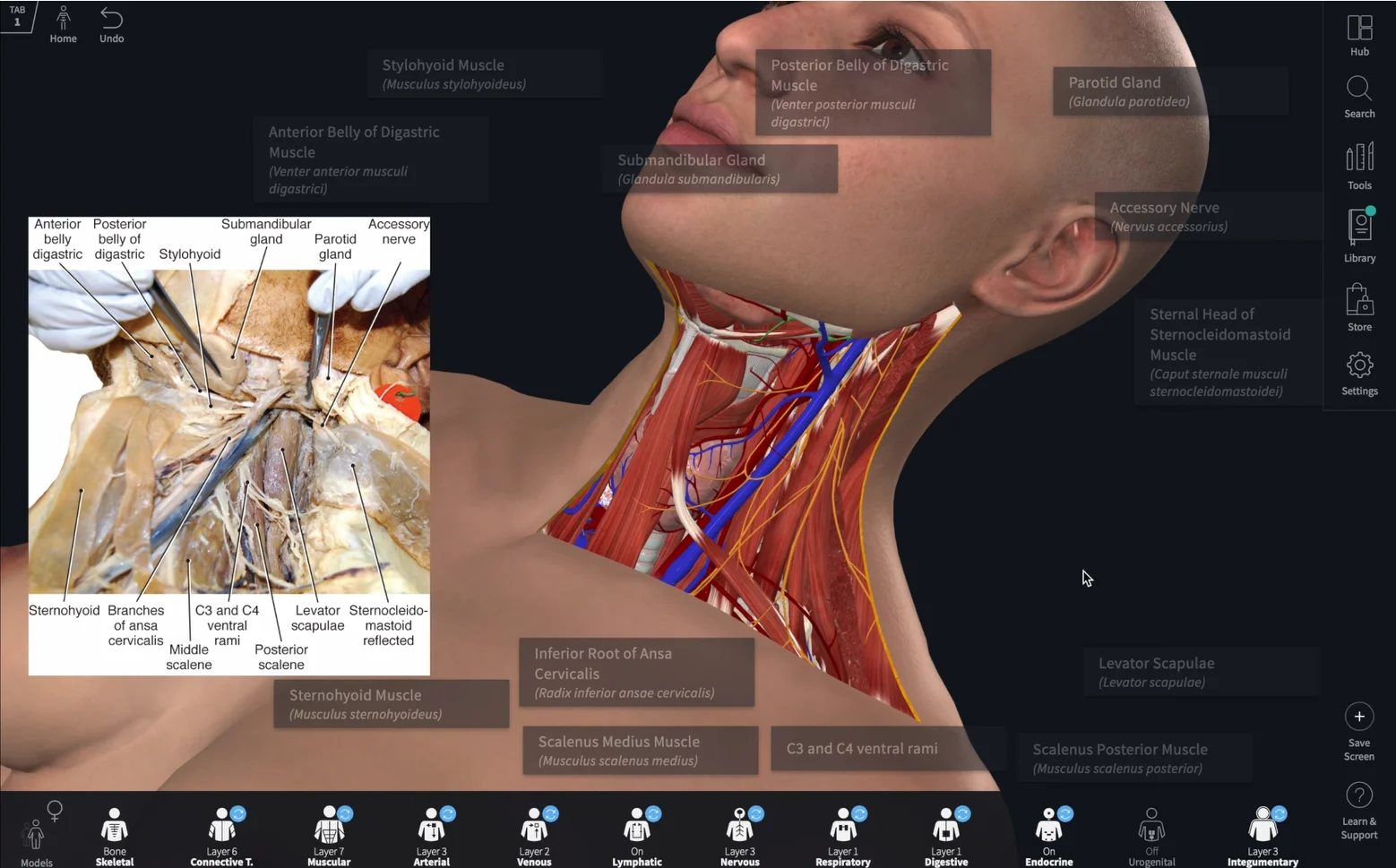 Using CA with Dissection