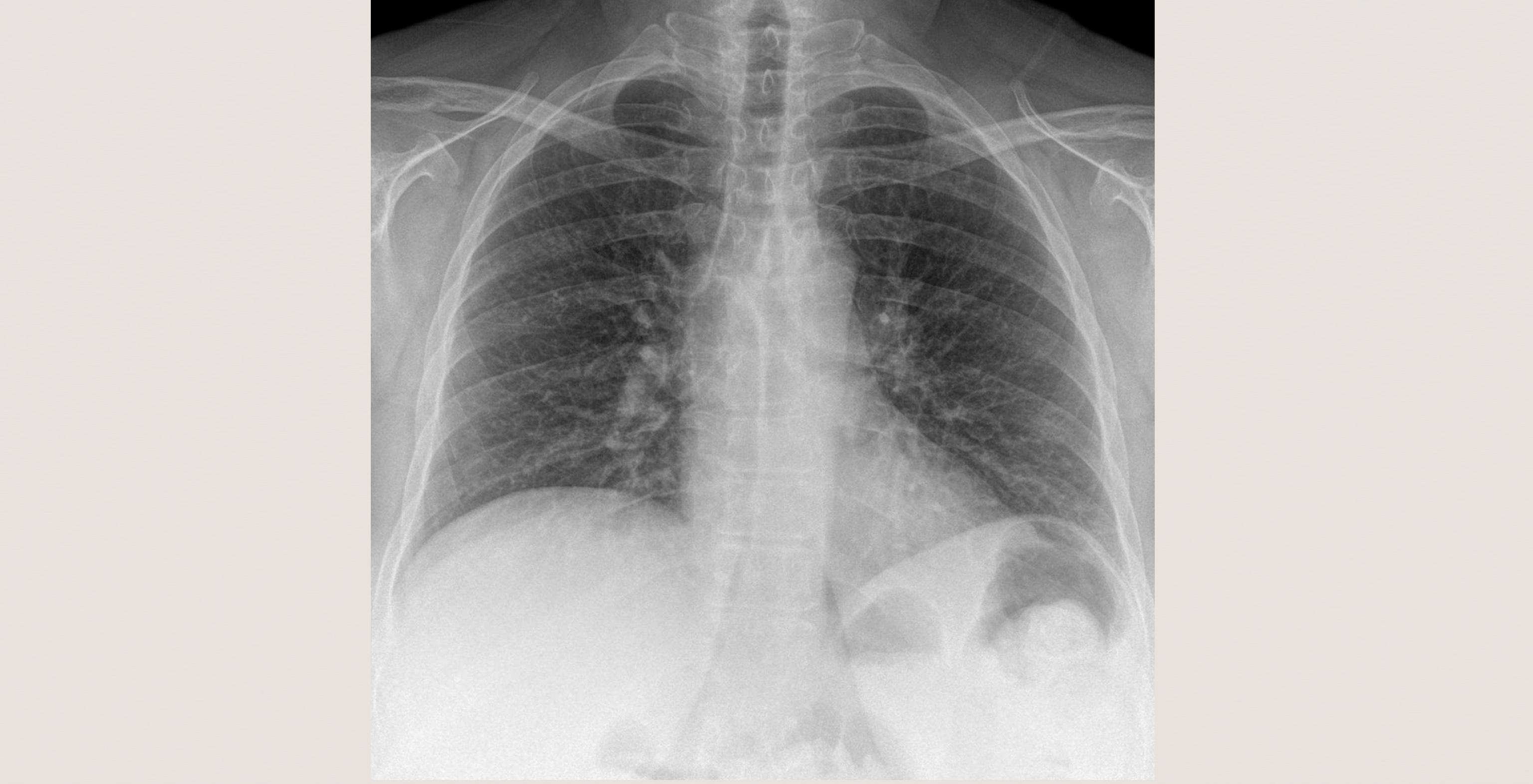 5-p4-1-radiology-chest
