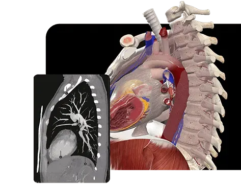 Image-5-Improve-radiology