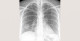 7-p4-3-radiology-chest
