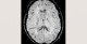 4-p1-4-radiology-brain