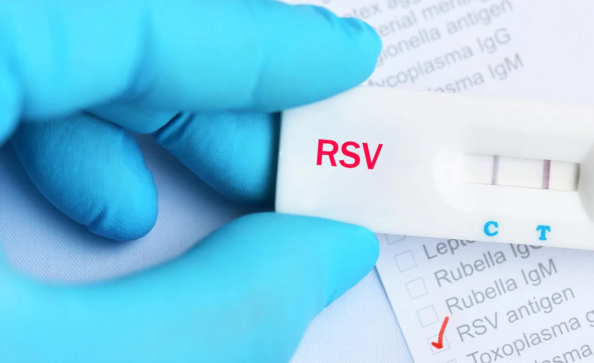 RSV CO - update 