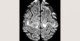 d2-radiology-brain