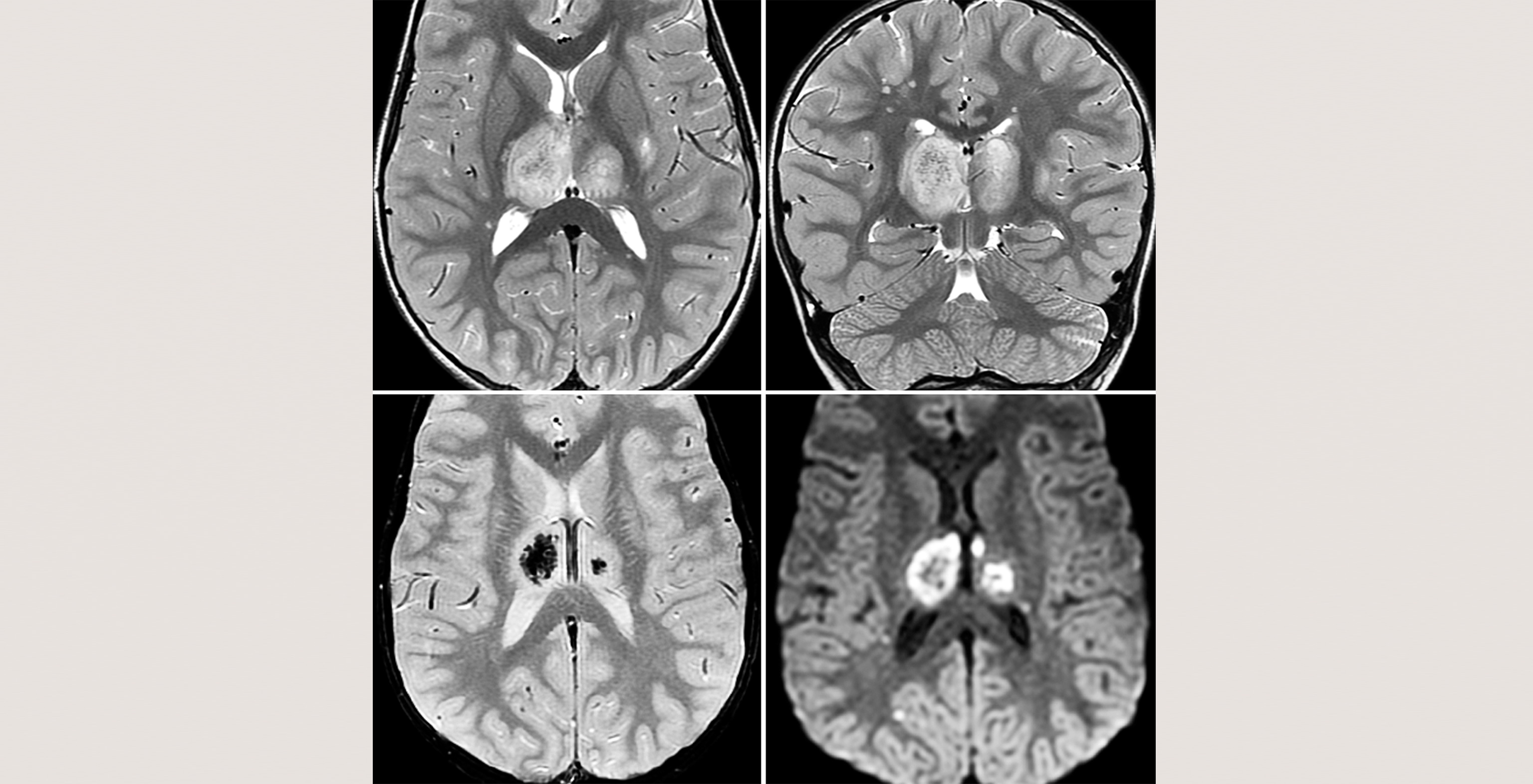 2-p1-2-radiology-brain