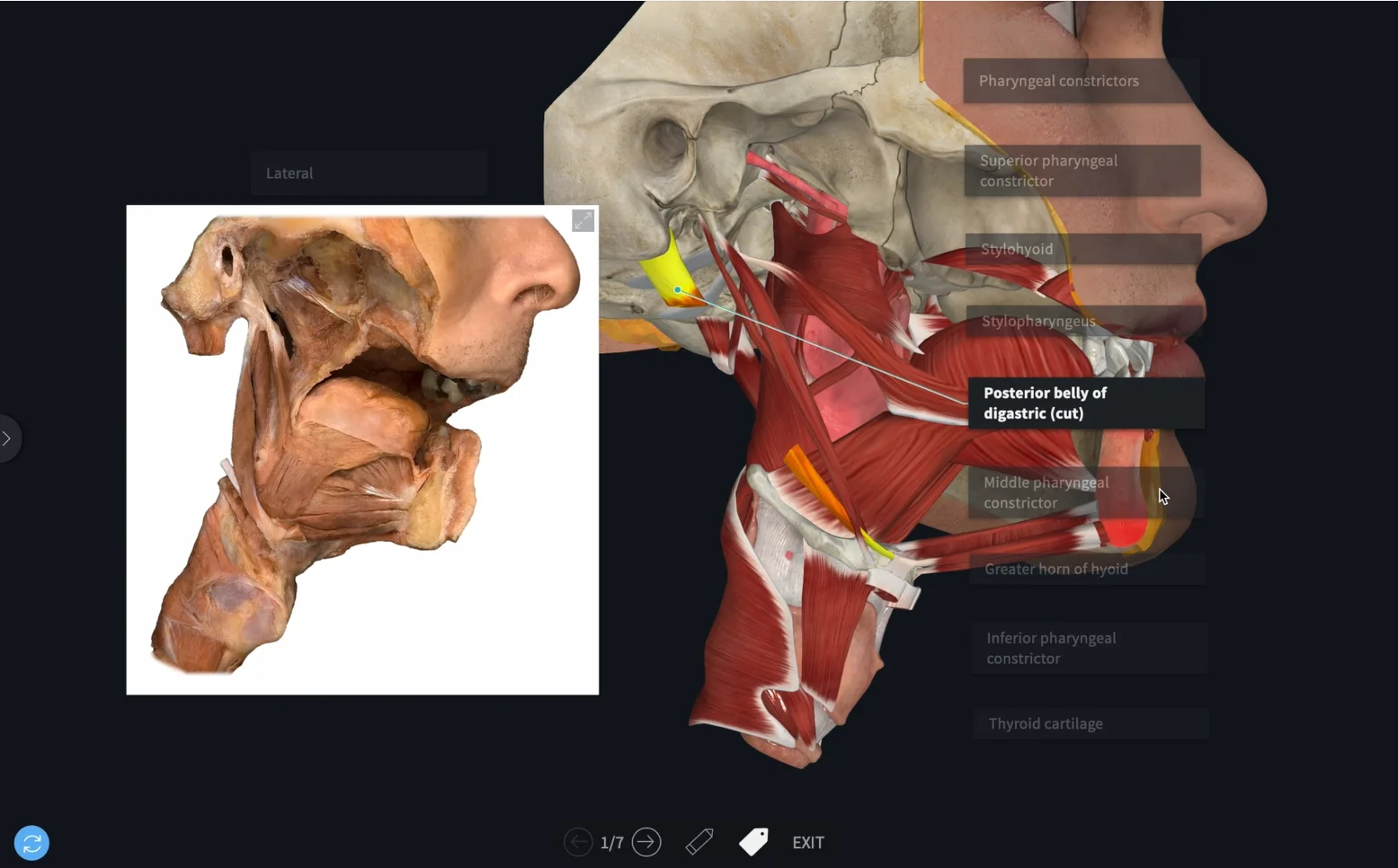 Prosection