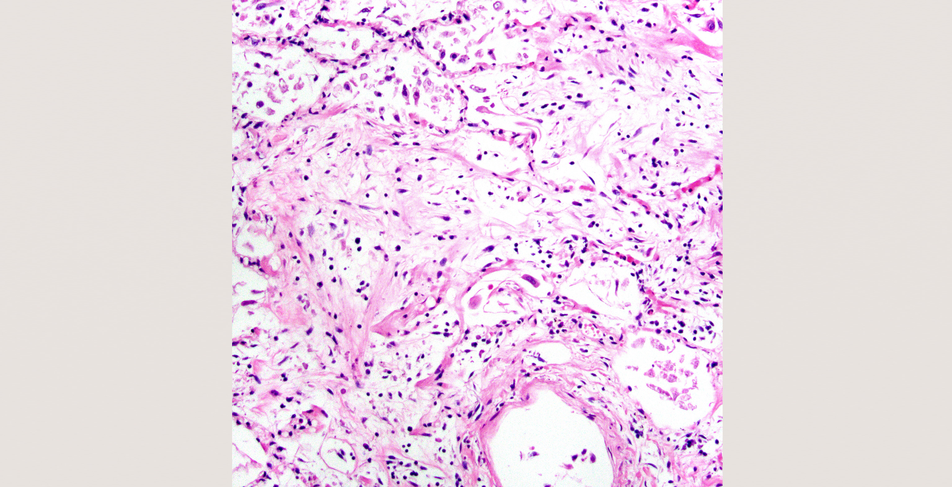 14-p6-4-pathology-id