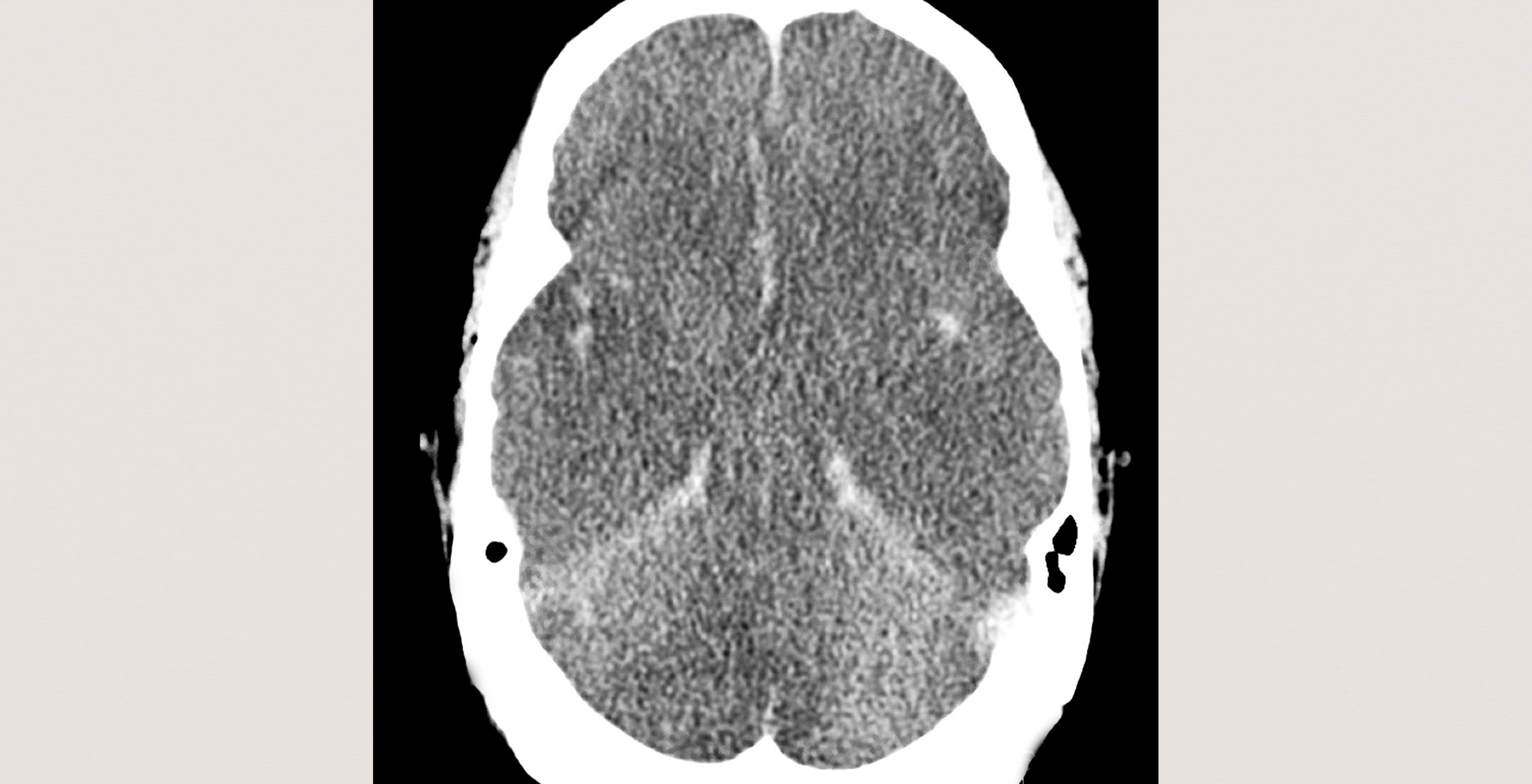 9-p4-5-radiology-brain