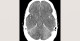 9-p4-5-radiology-brain
