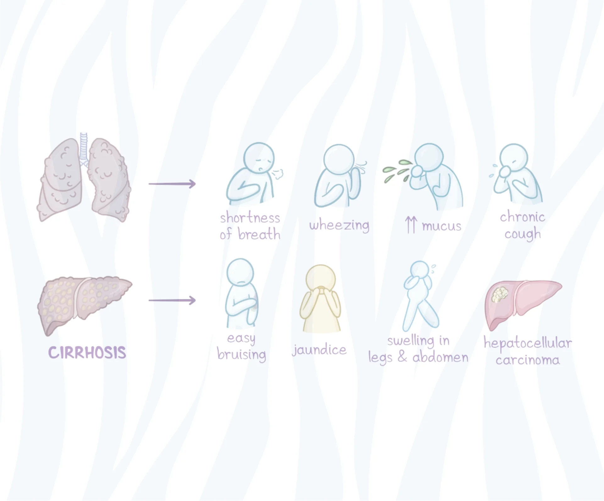 zebra_Video Thumbnail-Alpha-1 antitrypsin deficiency