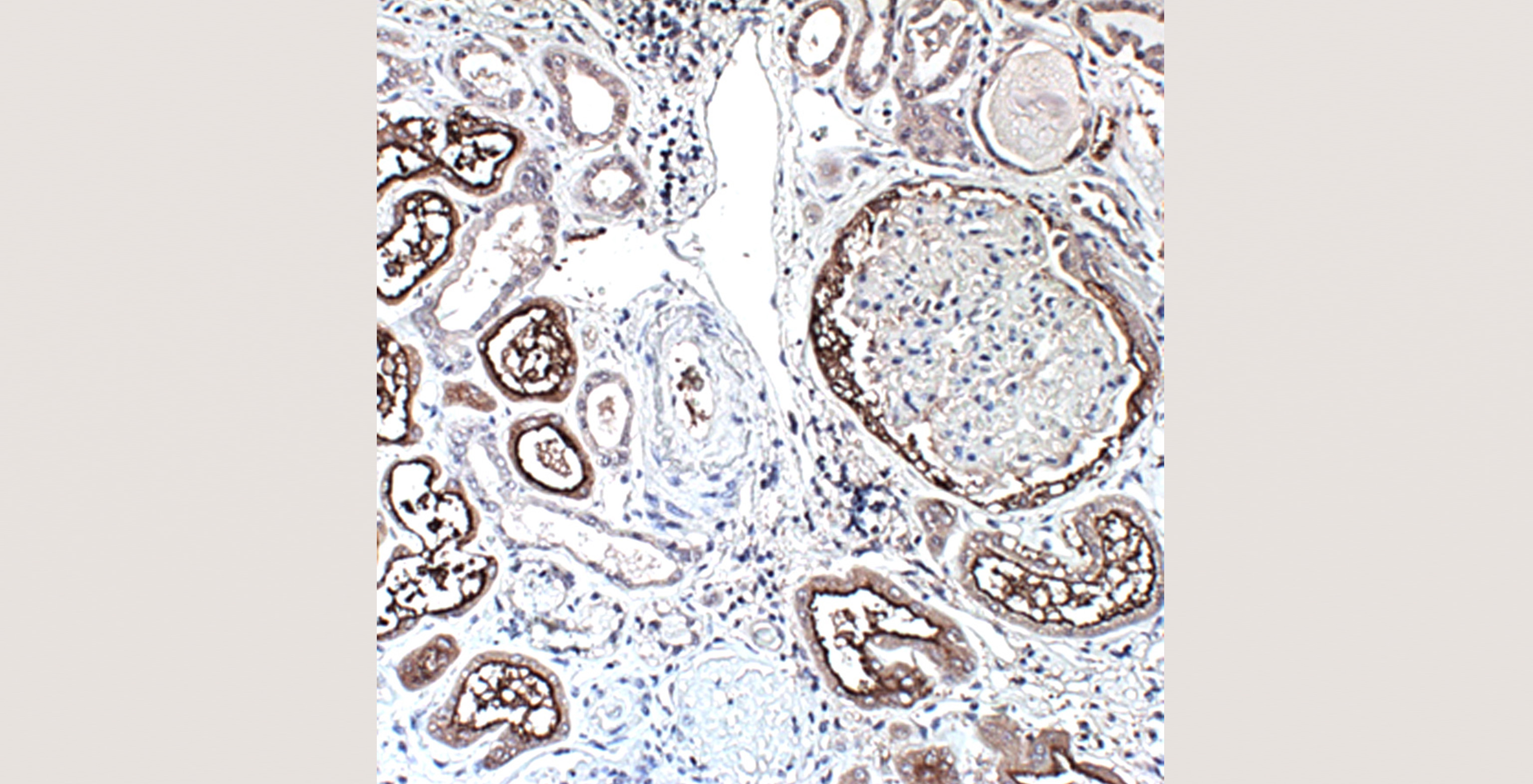 pathology-nephrology-10-p4-6