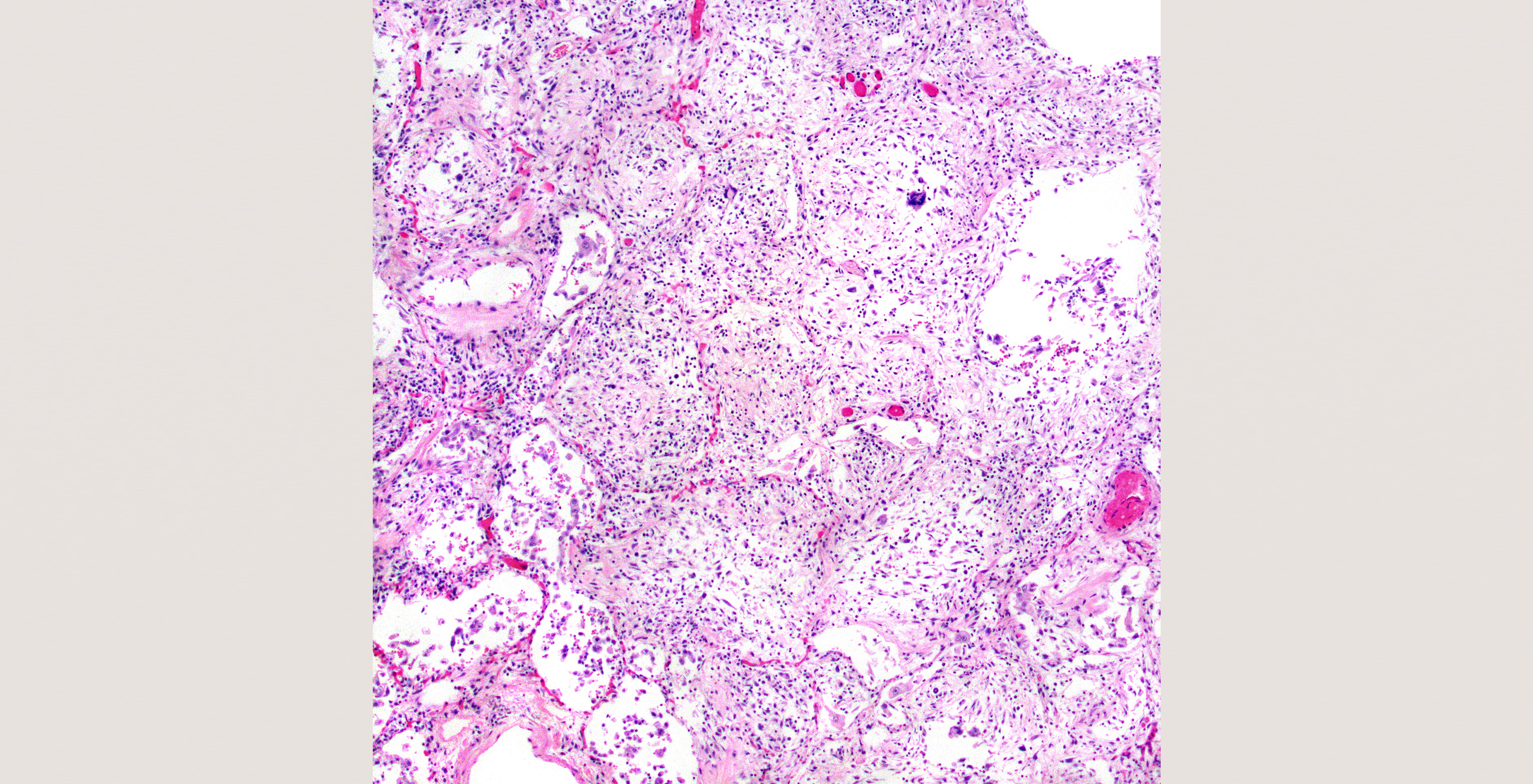 13-p6-3-pathology-id