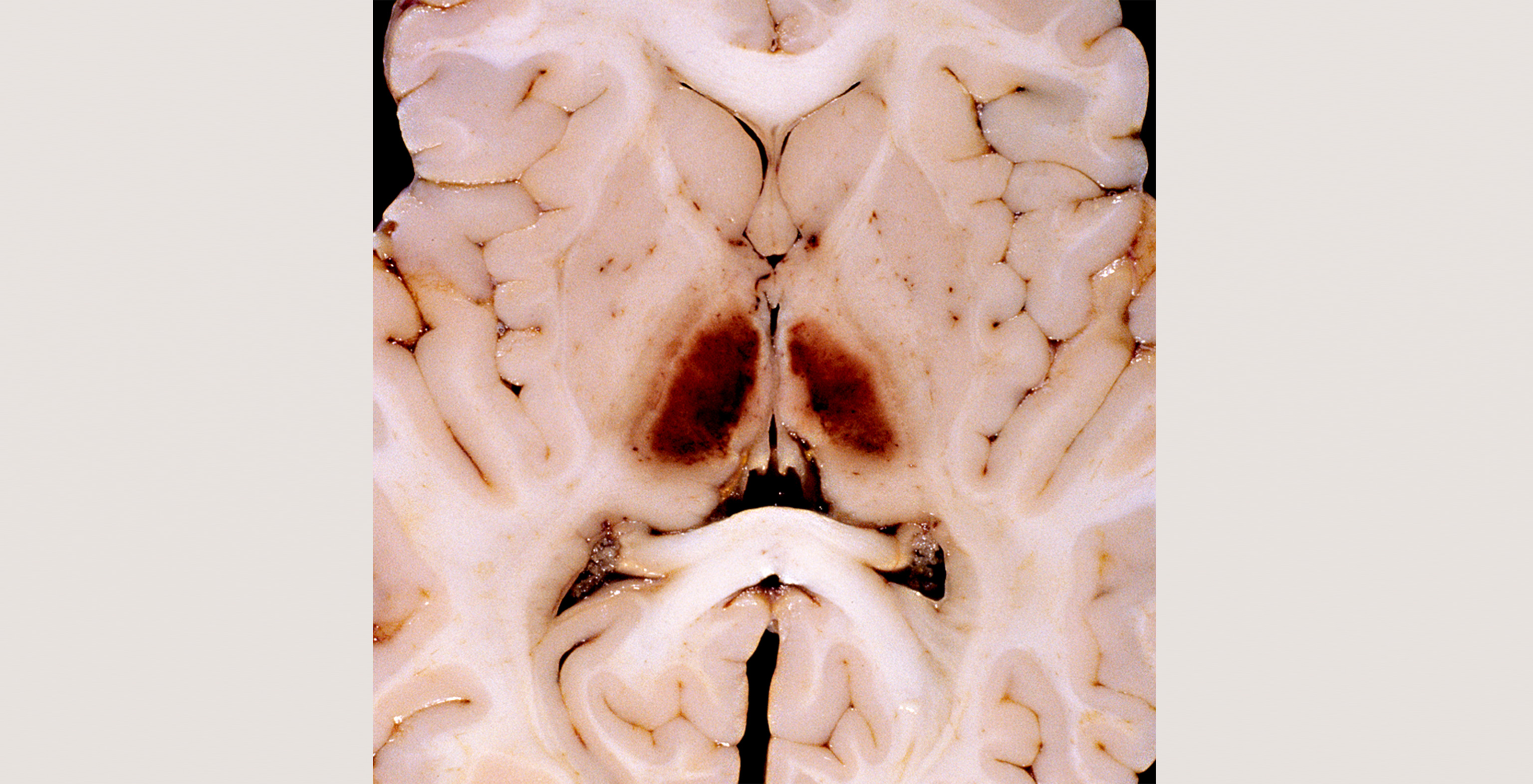 1-p1-1-radiology-brain