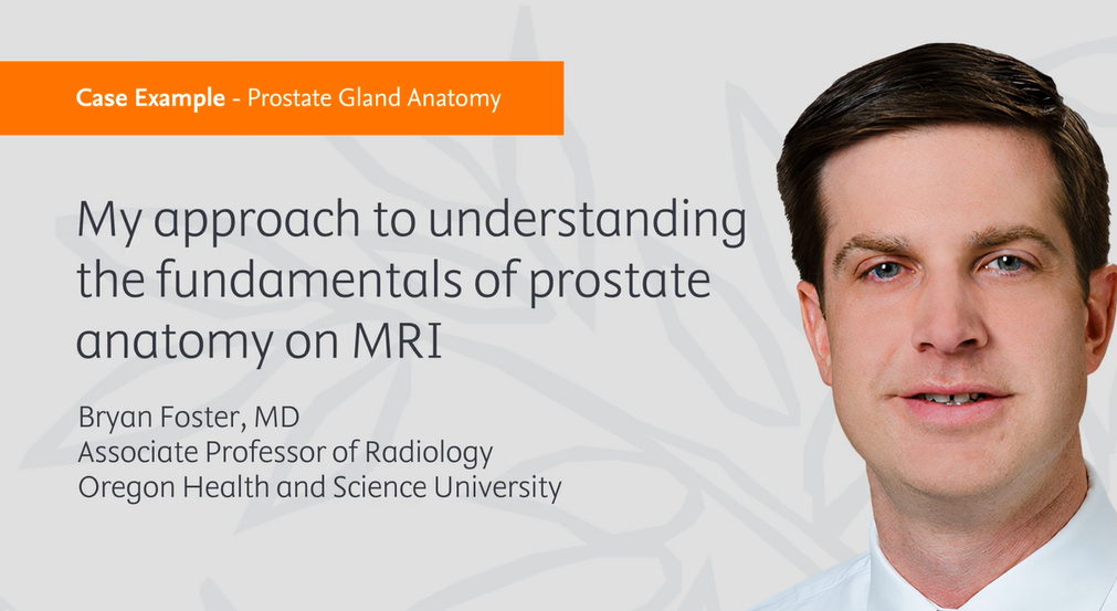 Prostate Gland Anatomy - Bryan Foster, MD (Fundamentals of Prostate Anatomy)