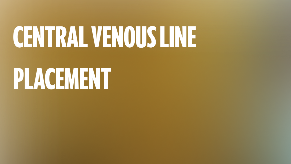 Central Venous Line Placement