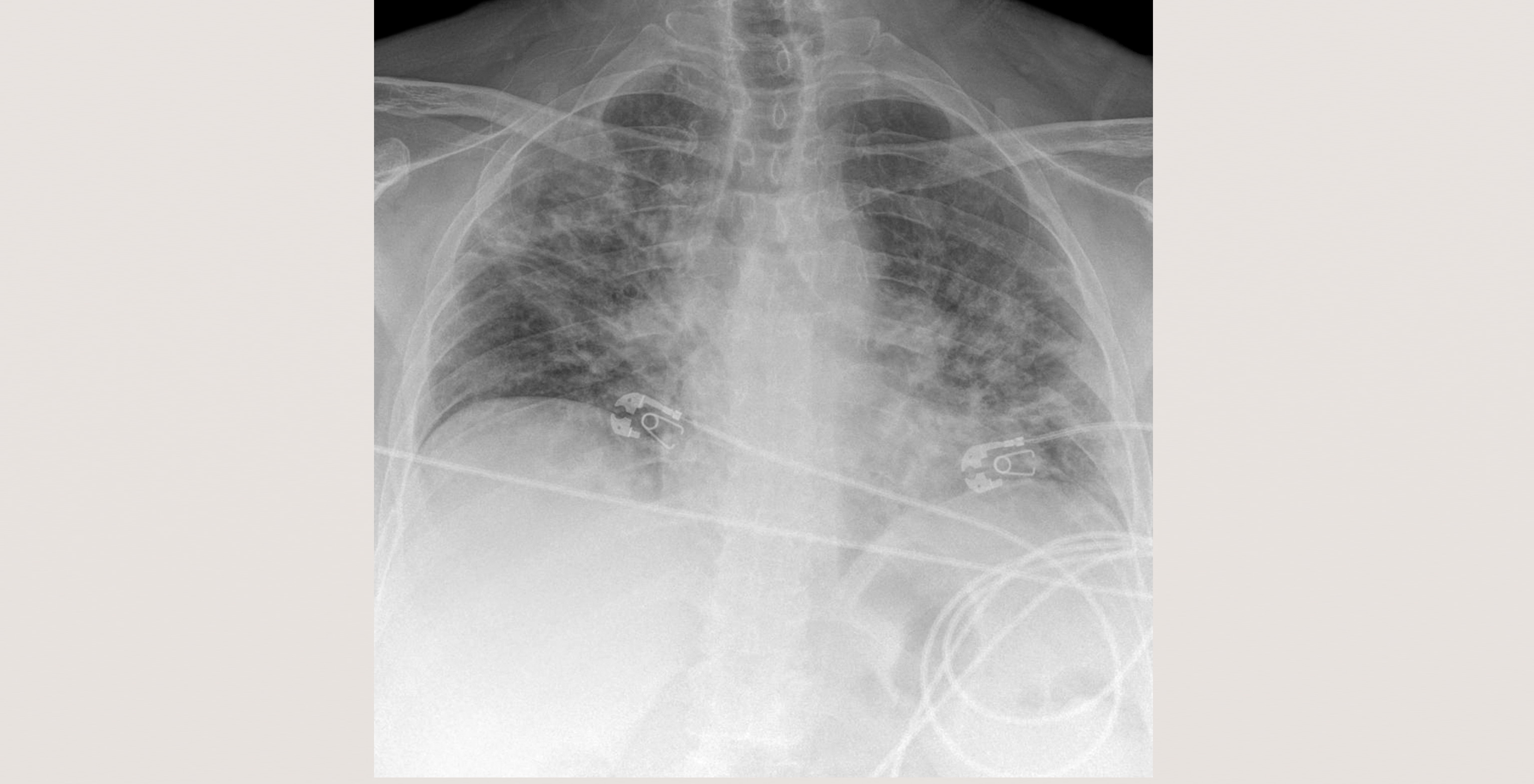 6-p4-2-radiology-chest