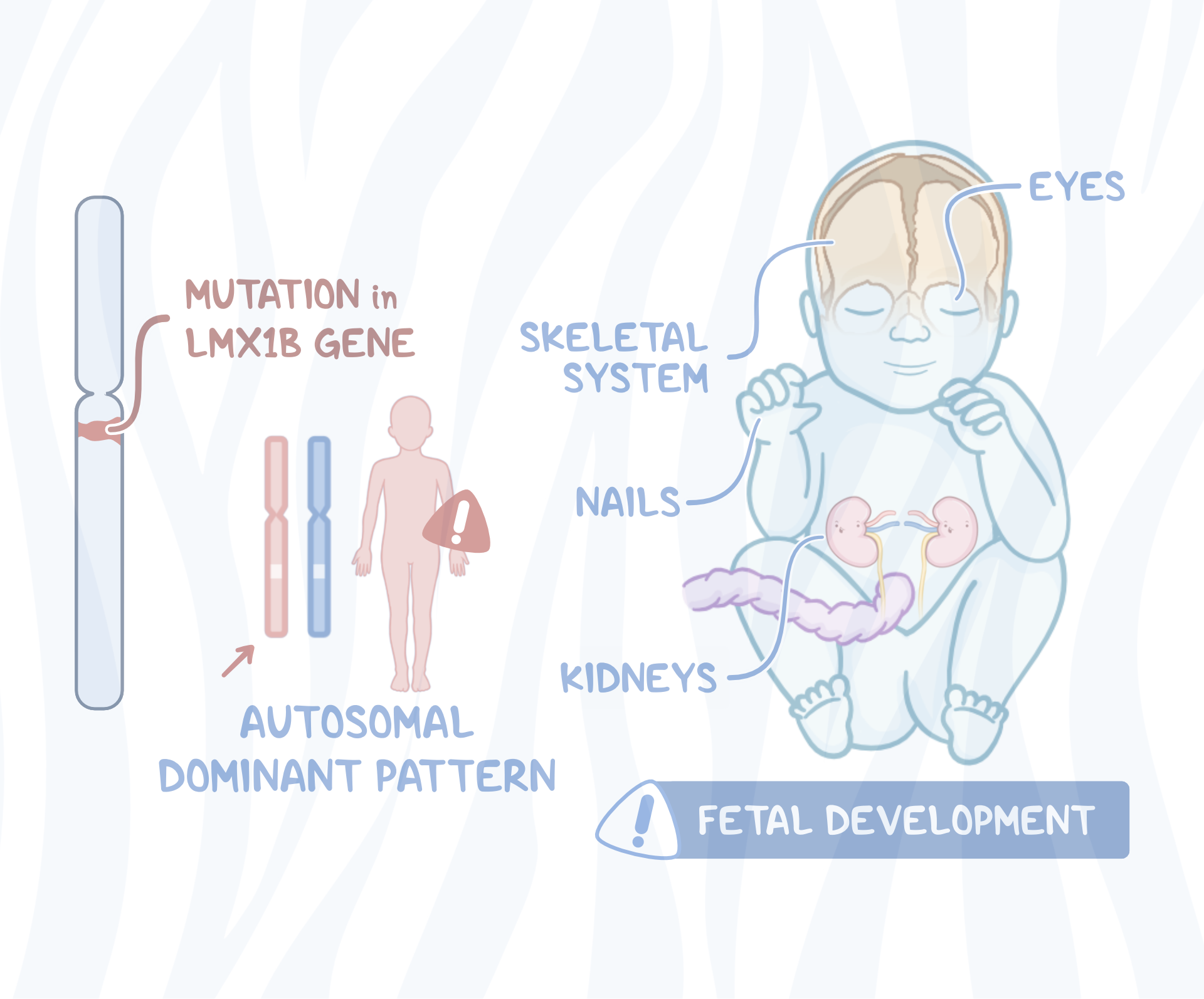 Prenatal diagnosis of nail patella syndrome: A case report