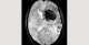 6-p4-2-radiology-brain
