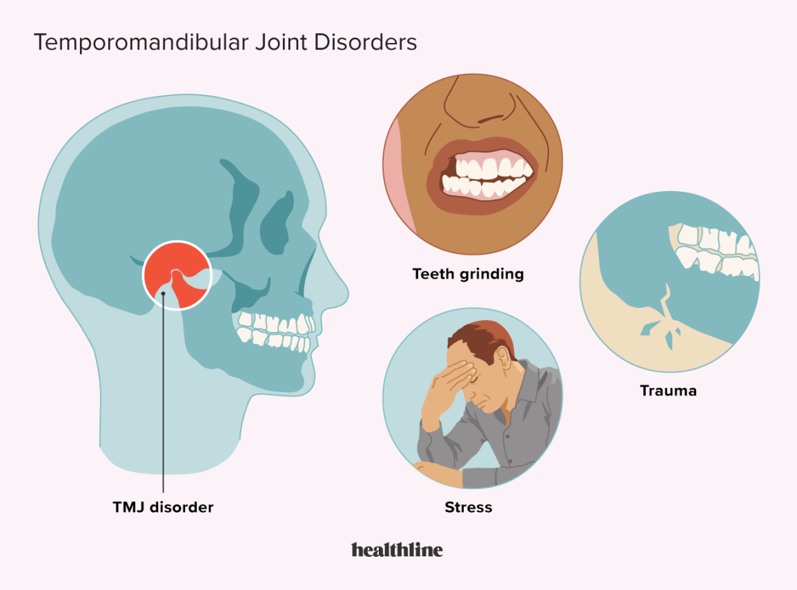 1855250-Temporomandibular-Joint-Disorders-1