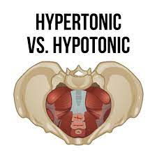 hypertonic pelvic floor, hypotonic pelvic floor