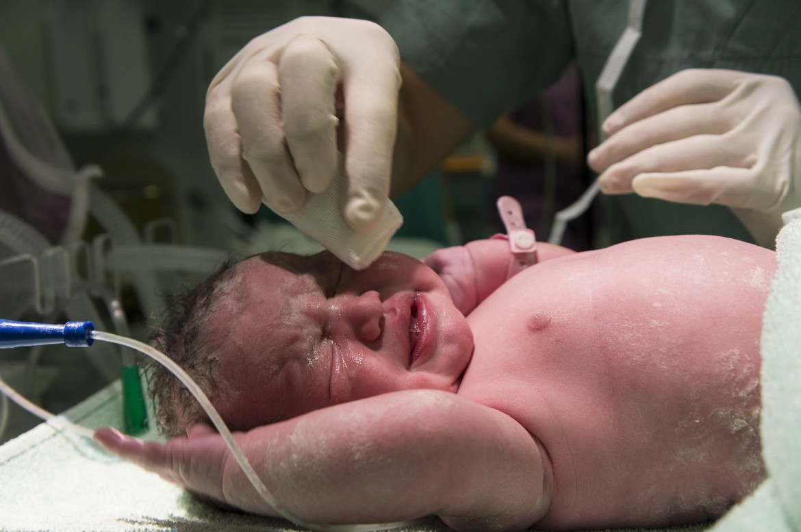 What is Asphyxia and how can we treat it in a newborn during childbirth? 