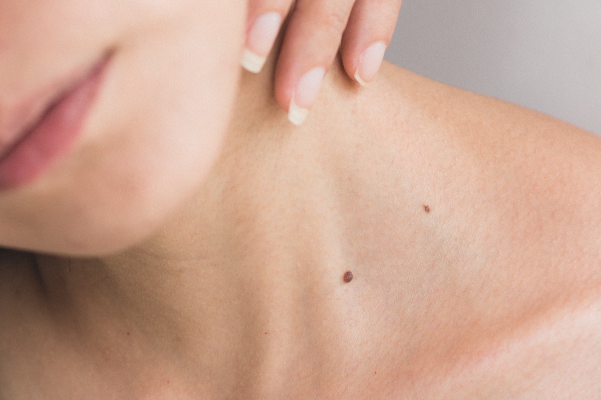 Skin Cancer Prevention