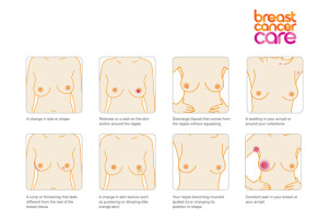 Breast Cancer Care: signs and symptoms of breast cancer