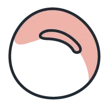 Mercury: The organic form of mercury can lead to adverse effects in children, and at high concentrations, long-term exposure can lead to kidney damage in adults.¹
