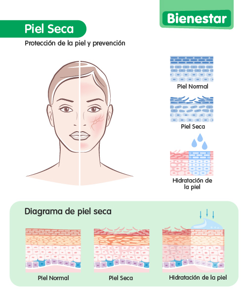 infografía piel seca