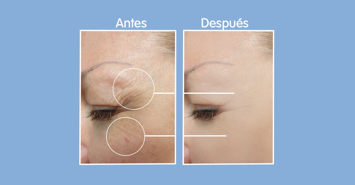 contorno de ojos