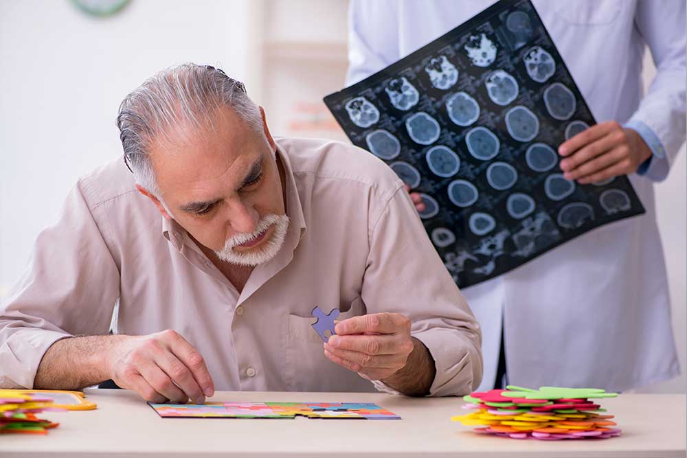 que es el Alzheimer 1