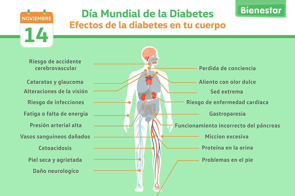 diabetes infografia