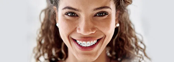Tips & Tricks for Wearing Braces 