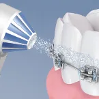 Best Water Flosser For Braces | Oral-B