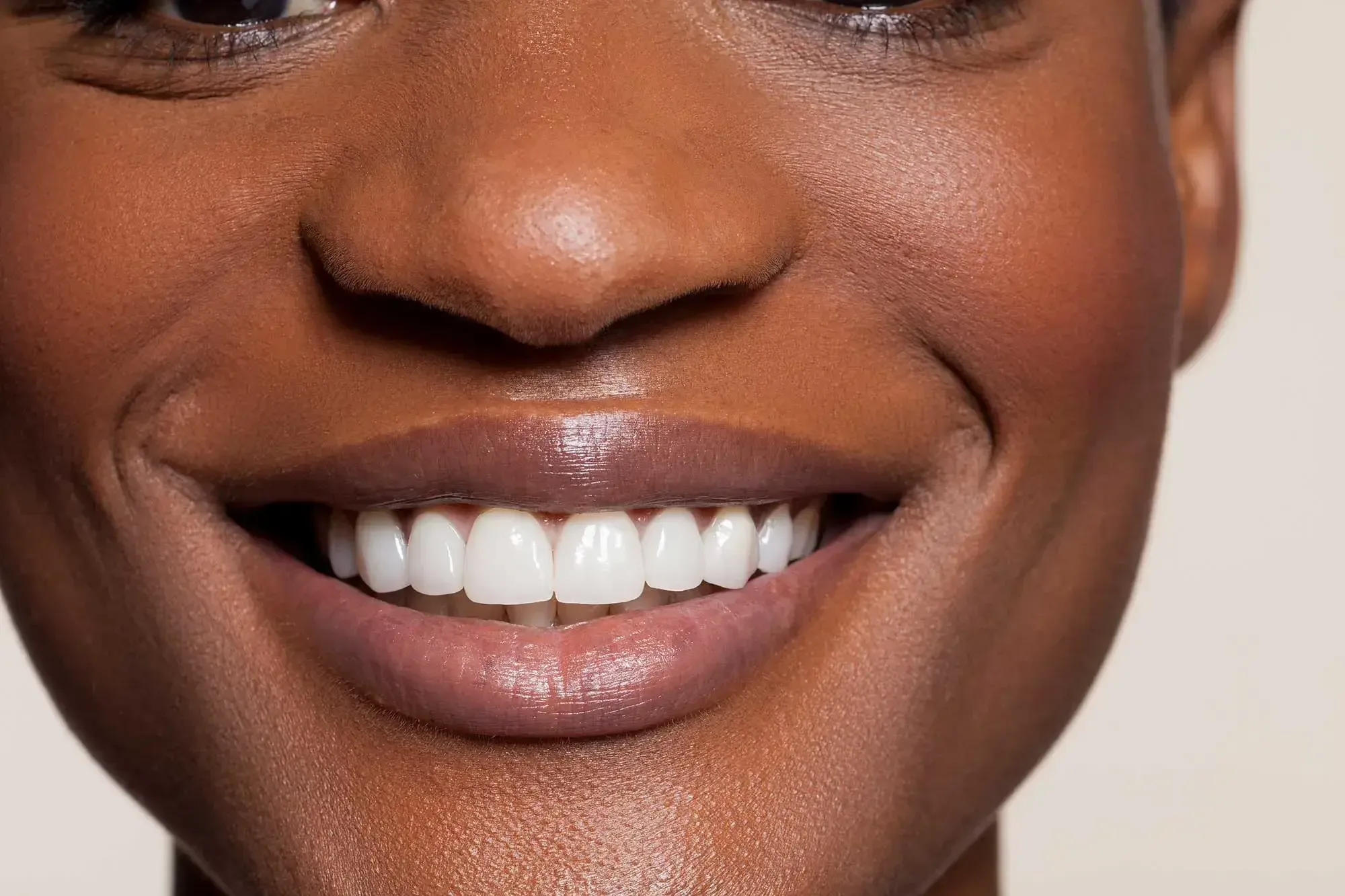 Article - What is Remineralisation? How to Remineralise Your Teeth - HERO