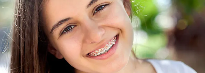 Frequently Asked Questions About Braces