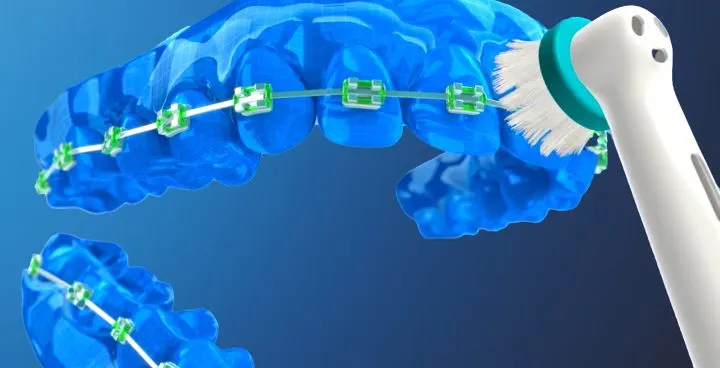 What is the Best Electric Toothbrush for Braces