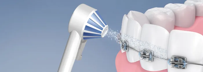  Water Flosser for Braces 