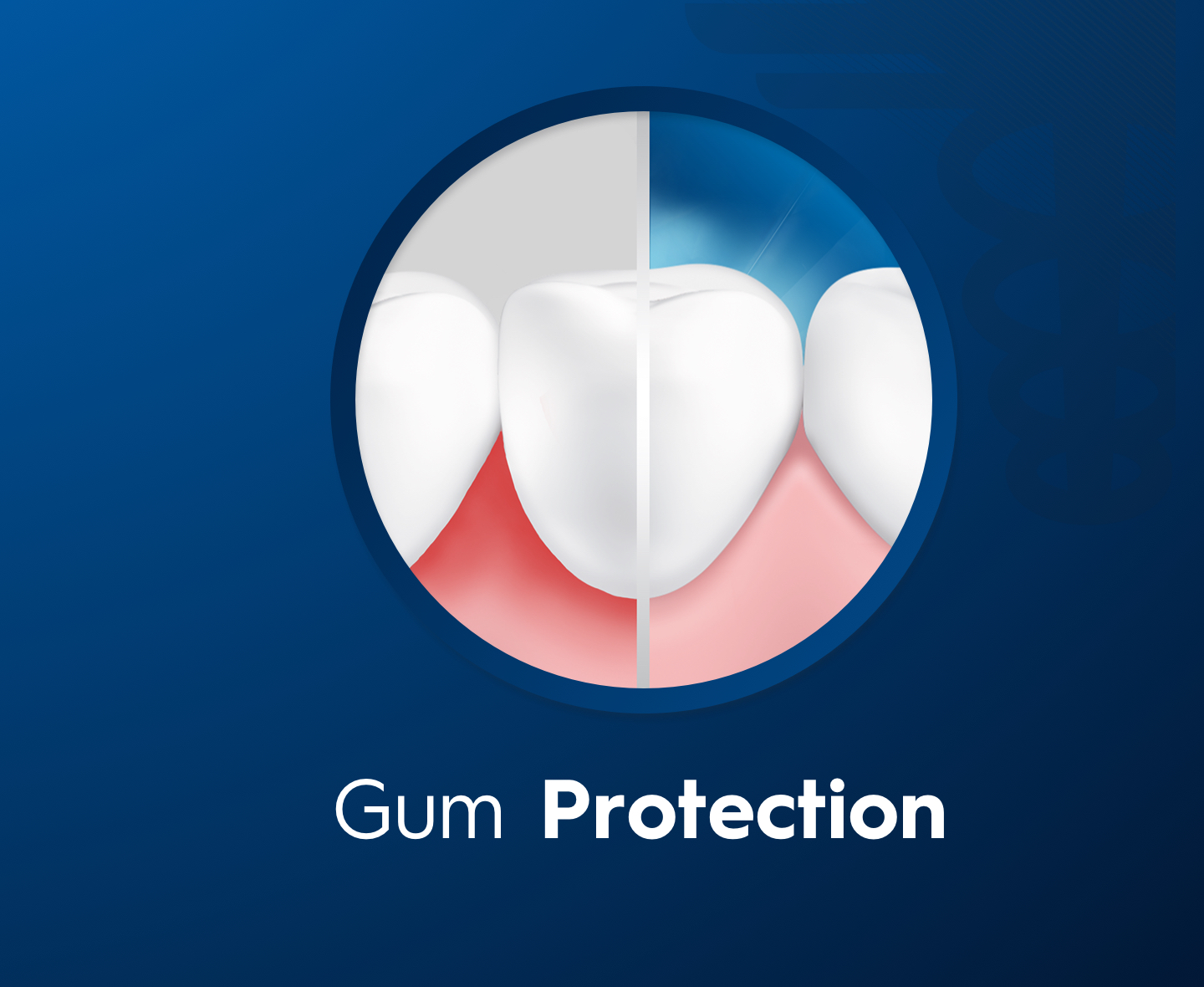 Gum protection