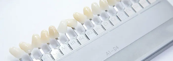 What Are Dental Veneers and How much do Teeth Veneers Cost?