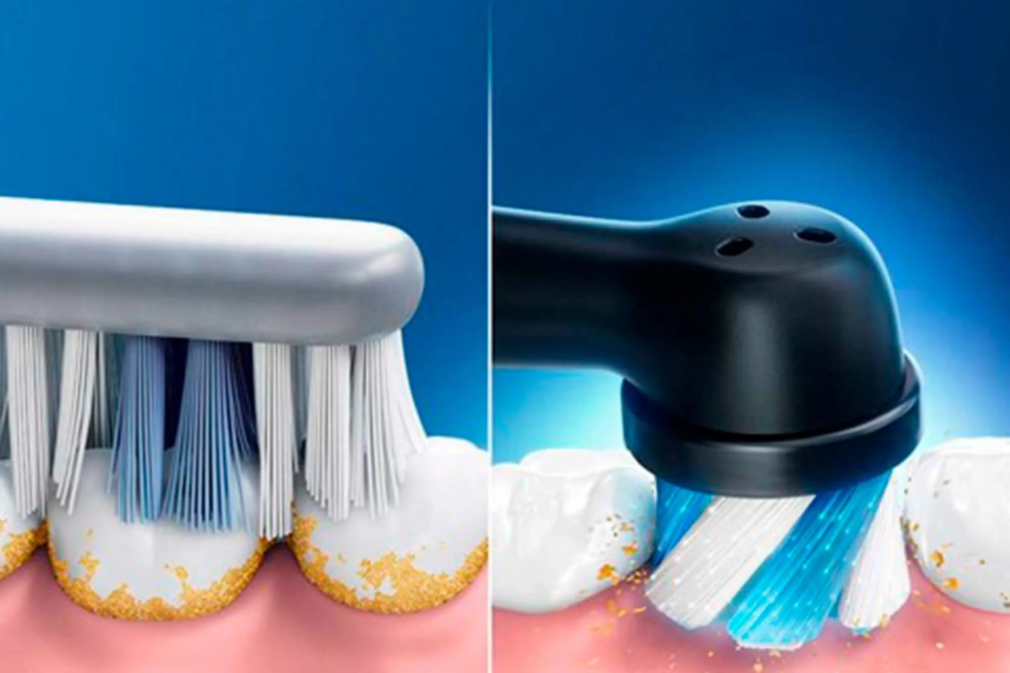 Image - Article - Electric vs. Manual Toothbrushes: Which Is Better?