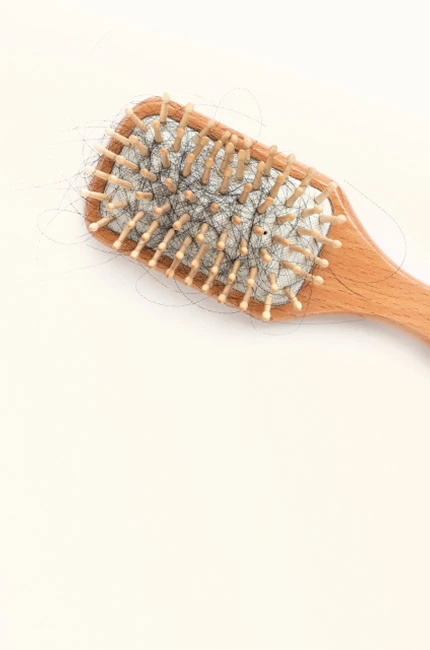 Escova cheia de fios de cabelo. São listadas causas comuns da queda capilar.