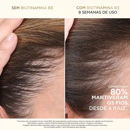 Imagem do produto: Creme para pentear Antiqueda com Biotinamina B3